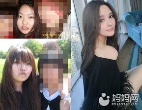 爆料小猪整容视频大全集,视频大全集深度解析